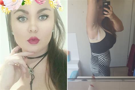 miss pamme|My boobs wont stop growing — I have a rare condition